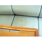 唯一の染み